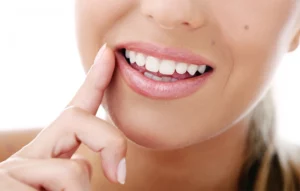 Teeth Whitening Frequency: The Ultimate Guide to Safe Whitening