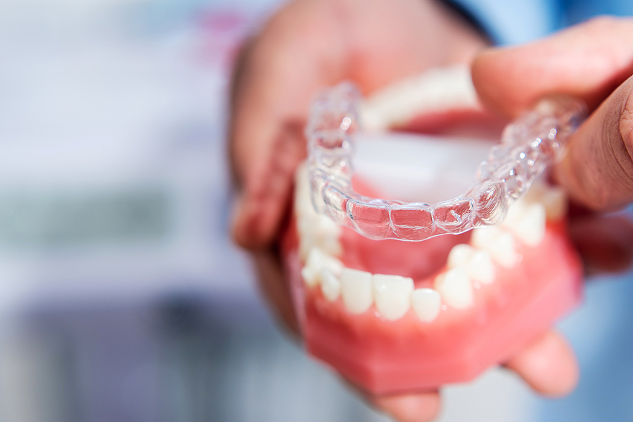 Invisalign Treatment in Brooklyn: What to Expect and Is It Worth It?