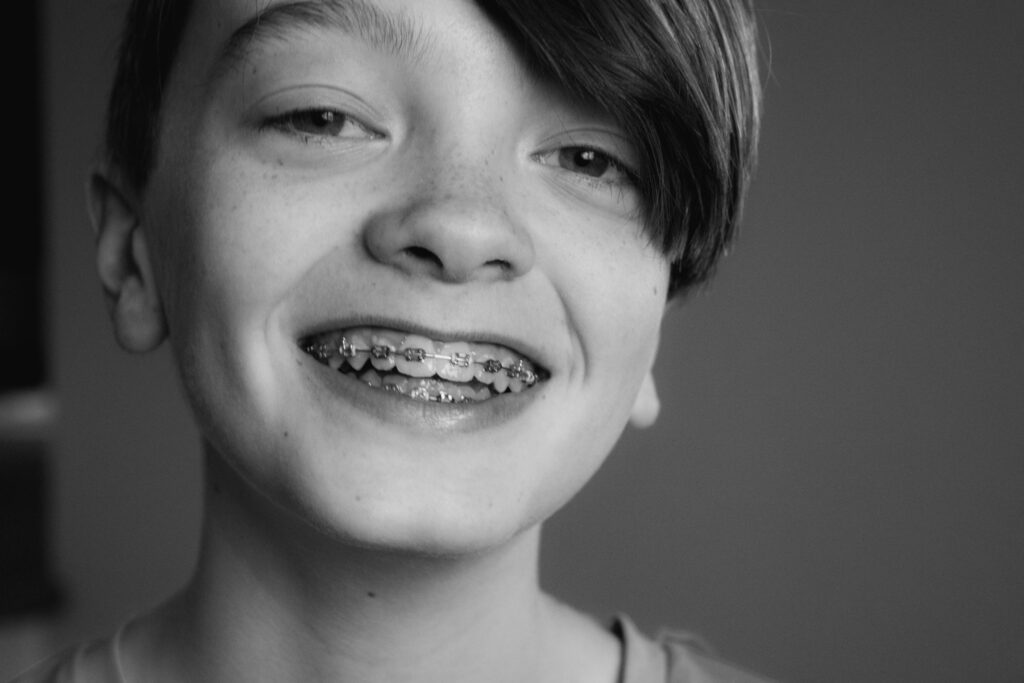 Best Age to Get Braces: The Ultimate Guide for Parents