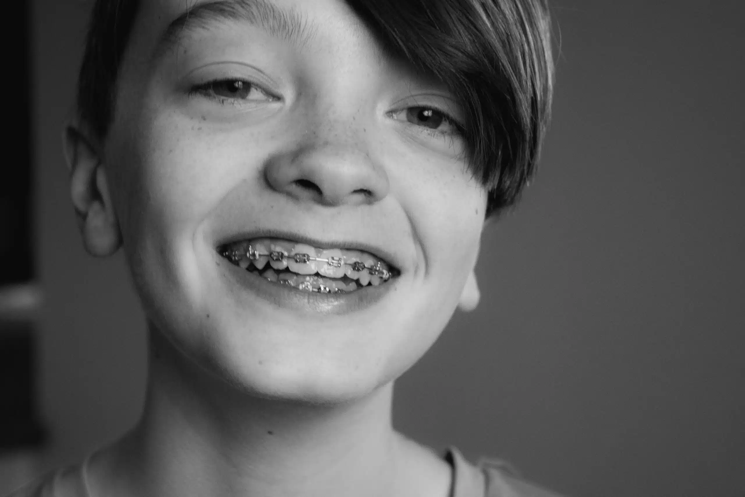Smiling child with braces, showcasing orthodontic treatment, emphasizing the importance of timing for effective dental care.