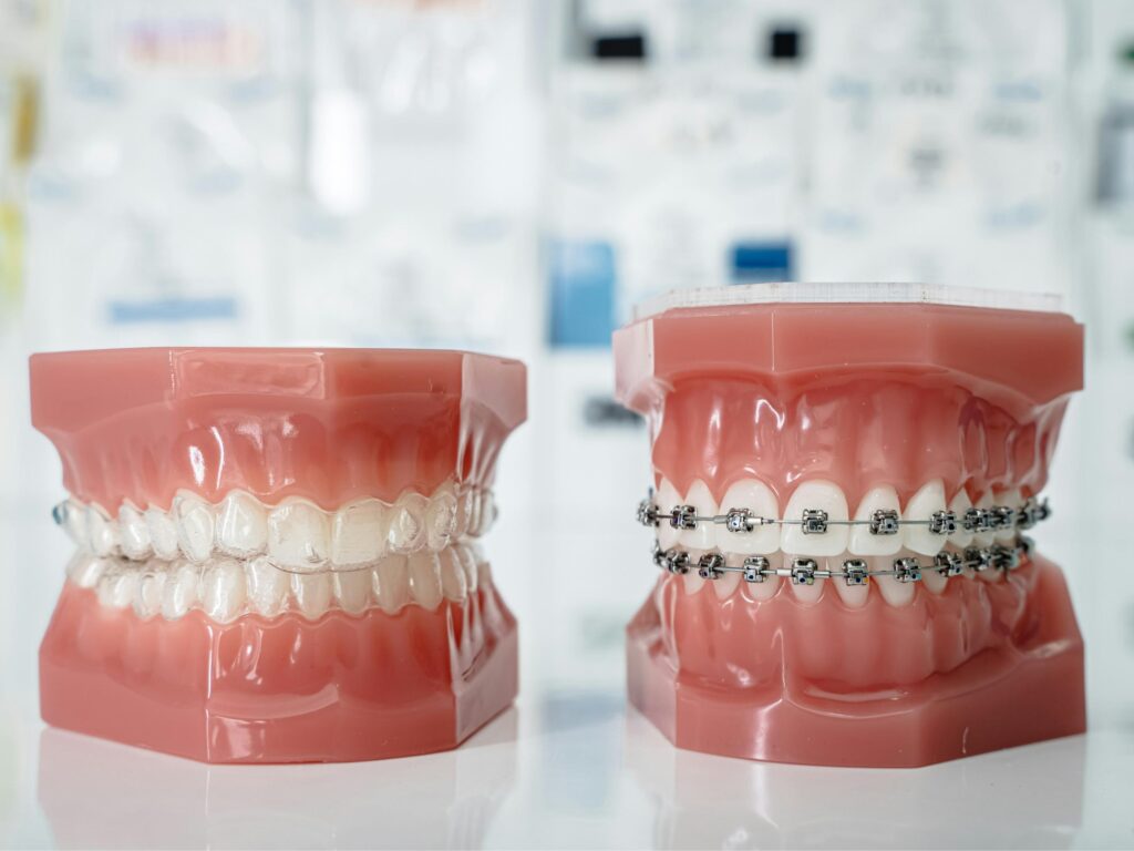 Invisalign vs Braces: Honest Breakdown of Pros, Cons, and Costs