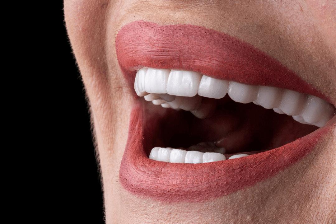 dentist holding porcelain venee