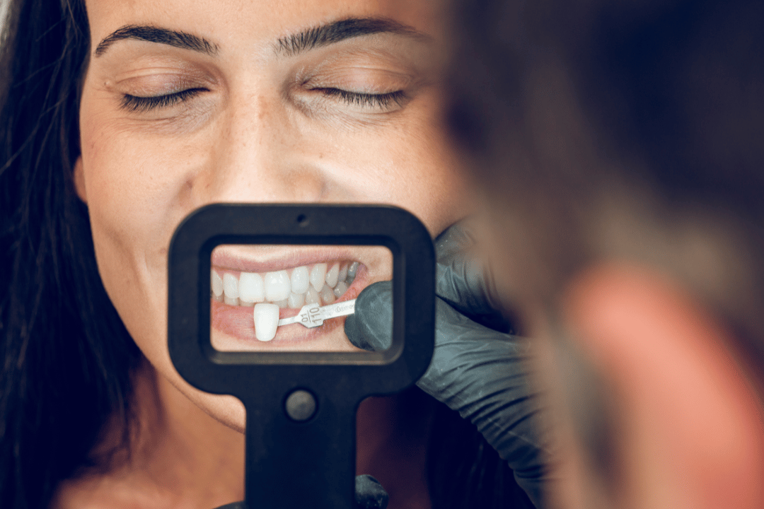 patient during veneer consultation