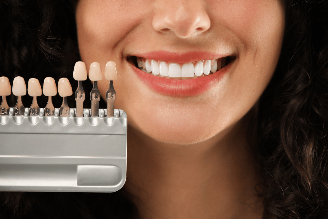 smile makeover Brooklyn dental office
