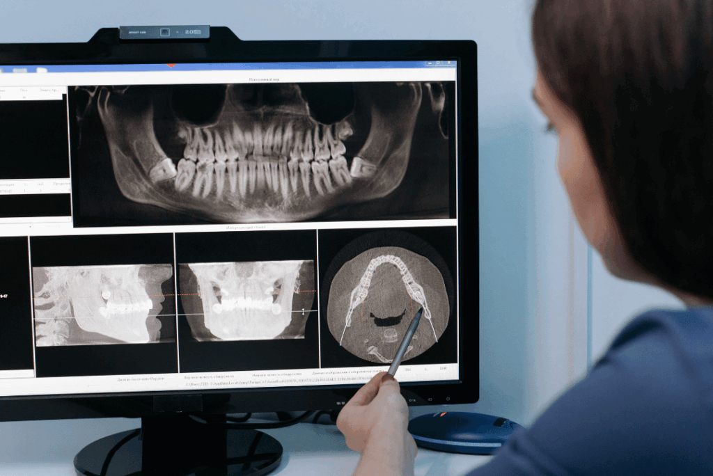 dental implants brooklyn