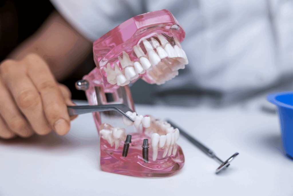 natural tooth restoration